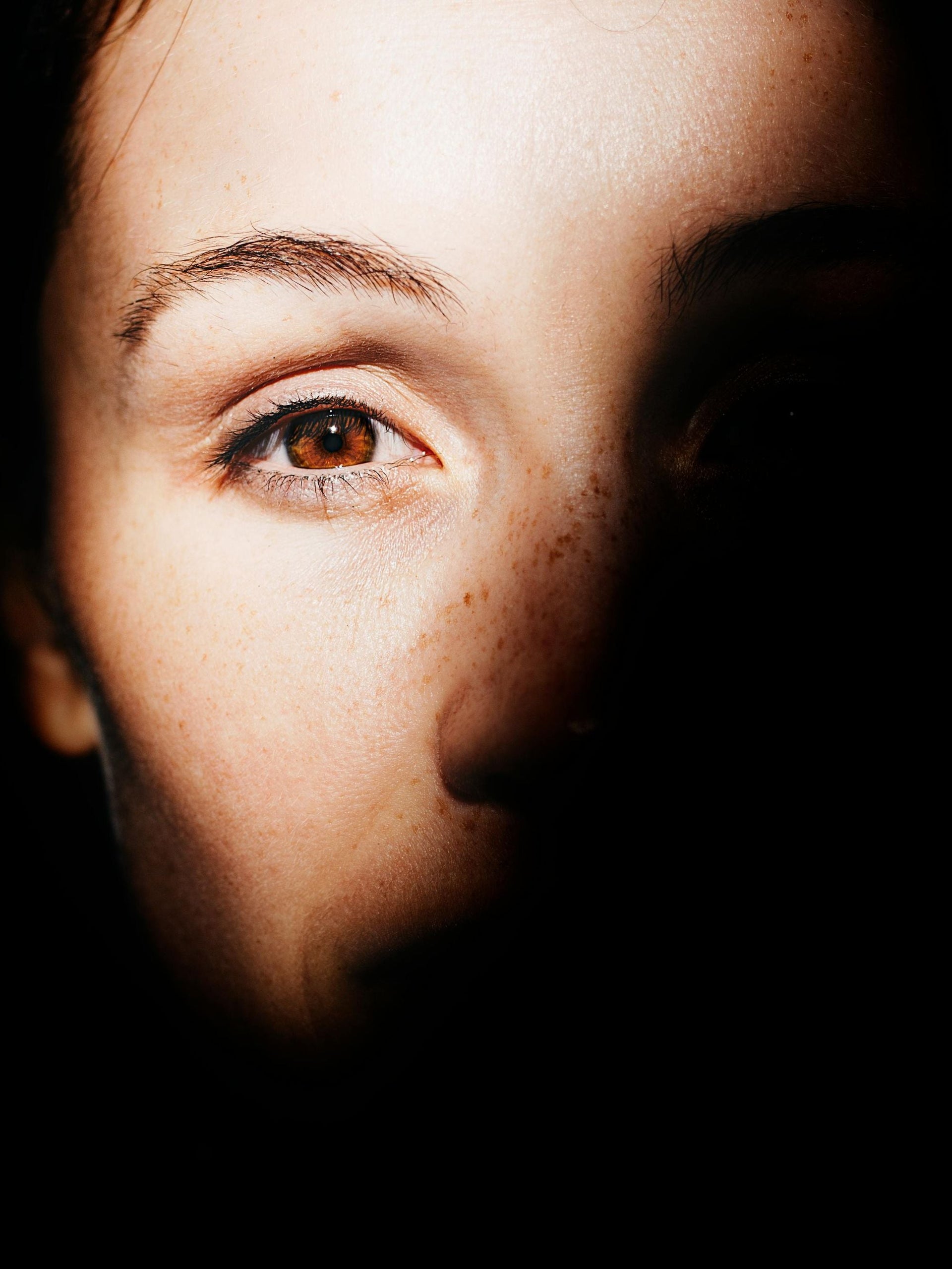 Noticed any of these aging signs around your eyes?